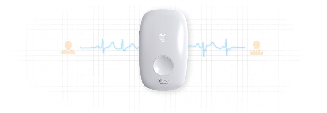 Cardiac monitor as IoT use case example